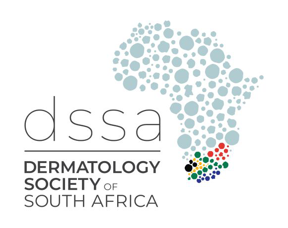 DSSA